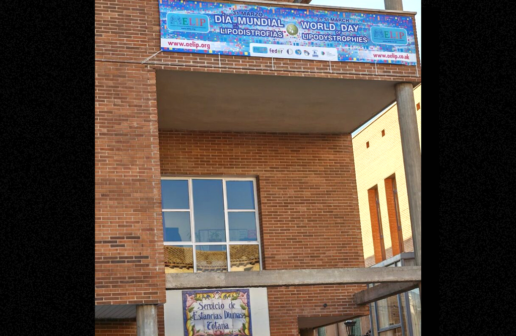 Totana luce la pancarta del D�a Mundial de las Lipodistrofias que se celebra el 31 de marzo